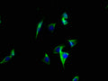 Immunofluorescence staining of A549 cells with CSB-PA002340LA01HU at 1:100, counter-stained with DAPI. The cells were fixed in 4% formaldehyde, permeabilized using 0.2% Triton X-100 and blocked in 10% normal Goat Serum. The cells were then incubated with the antibody overnight at 4°C. The secondary antibody was Alexa Fluor 488-congugated AffiniPure Goat Anti-Rabbit IgG(H+L).