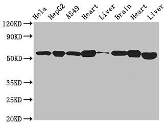 Western Blot
Positive WB detected in: Hela whole cell lysate, HepG2 whole cell lysate, A549 whole cell lysate, Mouse heart tissue, Mouse liver tissue, Mouse brain tissue, Rat heart tissue, Rat liver tissue
All lanes: ATP5B antibody at 2.7µg/ml
Secondary
Goat polyclonal to rabbit IgG at 1/50000 dilution
Predicted band size: 57 kDa
Observed band size: 57 kDa