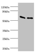Western blot
All lanes: ATP synthase subunit beta, mitochondrial antibody at 9ug/ml
Lane 1: Hela whole cell lysate
Lane 2: HepG2 whole cell lysate
Secondary
Goat polyclonal to rabbit IgG at 1/10000 dilution
Predicted band size: 57 kDa
Observed band size: 57 kDa