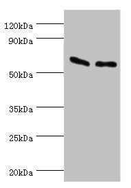 Western blot
All lanes: ATP synthase subunit beta, mitochondrial antibody at 9ug/ml
Lane 1: Hela whole cell lysate
Lane 2: HepG2 whole cell lysate
Secondary
Goat polyclonal to rabbit IgG at 1/10000 dilution
Predicted band size: 57 kDa
Observed band size: 57 kDa