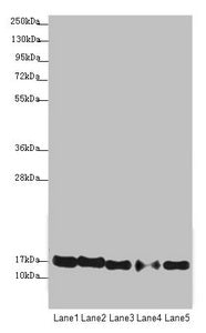 Western blot All lanes: ATP5F1D antibody at 1.94µg/ml Lane 1: Raji whole cell lysate Lane 2: NIH/3T3 whole cell lysate Lane 3: A549 whole cell lysate Lane 4: MDA-MB-231 whole cell lysate Lane 5: HepG2 whole cell lysate Secondary Goat polyclonal to rabbit IgG at 1/10000 dilution Predicted band size: 18 kDa Observed band size: 18 kDa