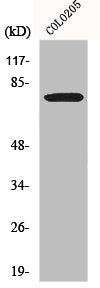 Western Blot analysis of COLO205 cells using EWS Polyclonal Antibody