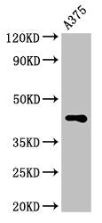 Western Blot
Positive WB detected in: A375 whole cell lysate
All lanes: AURKC antibody at 3.2µg/ml
Secondary
Goat polyclonal to rabbit IgG at 1/50000 dilution
Predicted band size: 36, 33, 34 kDa
Observed band size: 45 kDa