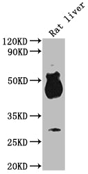 Western Blot
Positive WB detected in: Rat liver tissue
All lanes: Avpr1b antibody at 1:2000
Secondary
Goat polyclonal to rabbit IgG at 1/50000 dilution
Predicted band size: 48 kDa
Observed band size: 48 kDa