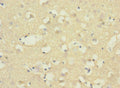 Immunohistochemistry of paraffin-embedded human brain tissue using CSB-PA002541ESR1HU at dilution of 1:100