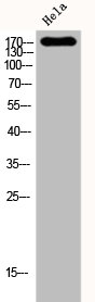 KDR Antibody – Figure 1 of 2