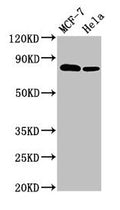 Western Blot
Positive WB detected in: MCF-7 whole cell lysate, Hela whole cell lysate
All lanes: BCAR1 antibody at 3.4µg/ml
Secondary
Goat polyclonal to rabbit IgG at 1/50000 dilution
Predicted band size: 94, 96, 78, 98 kDa
Observed band size: 78 kDa