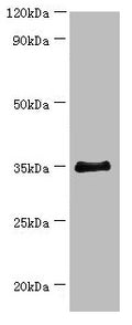 Western blot
All lanes: BCAT2 antibody at 14µg/ml + 293T whole cell lysate
Secondary
Goat polyclonal to rabbit IgG at 1/10000 dilution
Predicted band size: 45, 34 kDa
Observed band size: 34 kDa