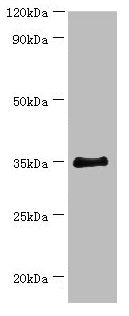 Western blot
All lanes: BCAT2 antibody at 14µg/ml + 293T whole cell lysate
Secondary
Goat polyclonal to rabbit IgG at 1/10000 dilution
Predicted band size: 45, 34 kDa
Observed band size: 34 kDa