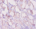 Immunohistochemistry of paraffin-embedded human kidney tissue using CSB-PA002611LA01MO at dilution of 1:20