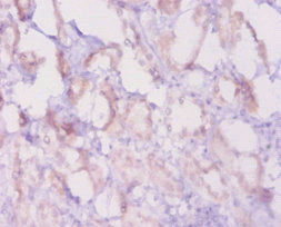 Bcl2 Antibody, HRP conjugated – Figure 1 of 1