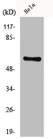 Western Blot analysis of Jurkat cells using GK2 Polyclonal Antibody