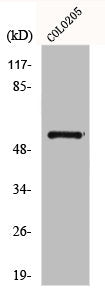 Western Blot analysis of COLO205 cells using Glucagon Receptor Polyclonal Antibody