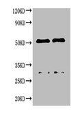 Western blotAll lanes : Canine IgG antibody at 2ug/ml
Lane 1 : Canine IgG protein 70ng
Lane 2 : Canine IgG protein 50ng
Secondary
Goat polyclonal to Rabbit IgG at 1/50000 dilution