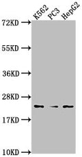 Western Blot
Positive WB detected in: K562 whole cell lysate, PC3 whole cell lysate, HepG2 whole cell lysate
All lanes: BLVRB antibody at 1:2000
Secondary
Goat polyclonal to rabbit IgG at 1/50000 dilution
Predicted band size: 23 kDa
Observed band size: 23 kDa