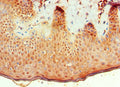 Immunohistochemistry of paraffin-embedded human skin tissue using CSB-PA002735ESR1HU at dilution of 1:100