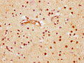 IHC image of CSB-PA002799LA01HU diluted at 1:600 and staining in paraffin-embedded human brain tissue performed on a Leica BondTM system. After dewaxing and hydration, antigen retrieval was mediated by high pressure in a citrate buffer (pH 6.0). Section was blocked with 10% normal goat serum 30min at RT. Then primary antibody (1% BSA) was incubated at 4&deg;C overnight. The primary is detected by a biotinylated secondary antibody and visualized using an HRP conjugated SP system.