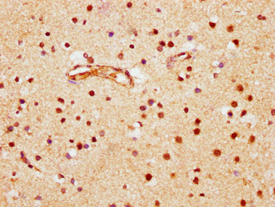 IHC image of CSB-PA002799LA01HU diluted at 1:600 and staining in paraffin-embedded human brain tissue performed on a Leica BondTM system. After dewaxing and hydration, antigen retrieval was mediated by high pressure in a citrate buffer (pH 6.0). Section was blocked with 10% normal goat serum 30min at RT. Then primary antibody (1% BSA) was incubated at 4&deg;C overnight. The primary is detected by a biotinylated secondary antibody and visualized using an HRP conjugated SP system.