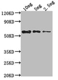 Western Blot
Positive WB detected in Recombinant protein
All lanes: mpII antibody at 1:2000
Secondary
Goat polyclonal to rabbit IgG at 1/50000 dilution
Predicted band size: 57 kDa
Observed band size: 58 kDa