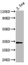 Western Blot
Positive WB detected in: recombinant protein
All lanes: chiA Antibody at 1:1000
Secondary
Goat polyclonal to rabbit IgG at 1/50000 dilution
Predicted band size: 32 kDa
Observed band size: 32 kDa