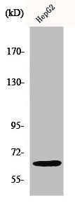 Western Blot analysis of HepG2 cells using IL-10Rα Polyclonal Antibody