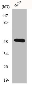 Western Blot analysis of HeLa cells using IL-11Rα Polyclonal Antibody
