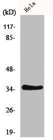 Western Blot analysis of HeLa cells using IL-20Rβ Polyclonal Antibody