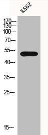 Western Blot analysis of K562 cells using IL-7R Polyclonal Antibody