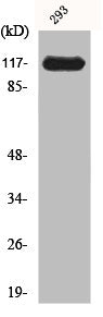 Western Blot analysis of 293 cells using JAK2 Polyclonal Antibody