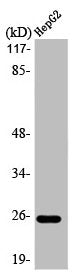 Western Blot analysis of HepG2 cells using LT-β Polyclonal Antibody