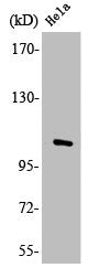 Western Blot analysis of HepG2 cells using LZK Polyclonal Antibody