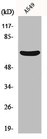 Western Blot analysis of A549 cells using MMP-11 Polyclonal Antibody