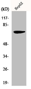 Western Blot analysis of HepG2 cells using MMP-16 Polyclonal Antibody