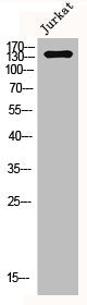 Western Blot analysis of Jurkat cells using NCAM-L1 Polyclonal Antibody