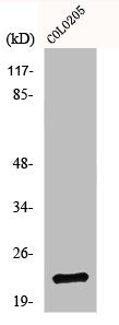 Western Blot analysis of 293 cells using NDUFB9 Polyclonal Antibody