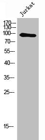 Western Blot analysis of Jurkat cells using NFκB-p100 Polyclonal Antibody