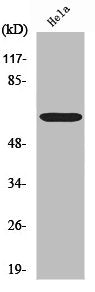 Western Blot analysis of Jurkat cells using NFκB-p65 Polyclonal Antibody