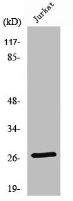 Western Blot analysis of Jurkat cells using NGF Polyclonal Antibody