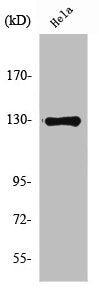 Western Blot analysis of HeLa cells using NOS2 Polyclonal Antibody