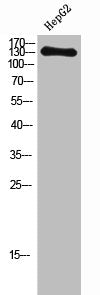 Western Blot analysis of HepG2 cells using NOS3 Polyclonal Antibody