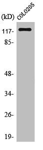 Western Blot analysis of COLO205 cells using Ob-R Polyclonal Antibody