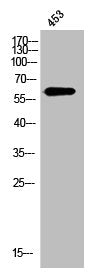 Western Blot analysis of 453 cells using OPN Polyclonal Antibody