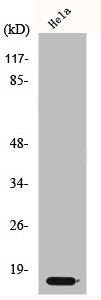 Western Blot analysis of HeLa cells using p14 Polyclonal Antibody