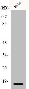 Western Blot analysis of HeLa cells using p15 Polyclonal Antibody