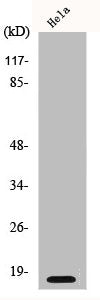 Western Blot analysis of HeLa cells using p16 Polyclonal Antibody