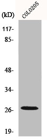 Western Blot analysis of COLO205 cells using p27 Polyclonal Antibody