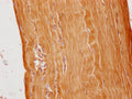 IHC image of CSB-PA003654PA01HU diluted at 1:100 and staining in paraffin-embedded human skeletal muscle tissue performed on a Leica BondTM system. After dewaxing and hydration, antigen retrieval was mediated by high pressure in a citrate buffer (pH 6.0). Section was blocked with 10% normal goat serum 30min at RT. Then primary antibody (1% BSA) was incubated at 4°C overnight. The primary is detected by a Goat anti-rabbit polymer IgG labeled by HRP and visualized using 0.05% DAB.