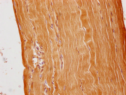 IHC image of CSB-PA003654PA01HU diluted at 1:100 and staining in paraffin-embedded human skeletal muscle tissue performed on a Leica BondTM system. After dewaxing and hydration, antigen retrieval was mediated by high pressure in a citrate buffer (pH 6.0). Section was blocked with 10% normal goat serum 30min at RT. Then primary antibody (1% BSA) was incubated at 4°C overnight. The primary is detected by a Goat anti-rabbit polymer IgG labeled by HRP and visualized using 0.05% DAB.