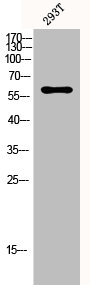 Western Blot analysis of 293T cells using p70 S6 kinase α Polyclonal Antibody