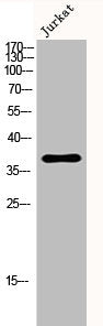 Western Blot analysis of Jurkat cells using PAI-1 Polyclonal Antibody